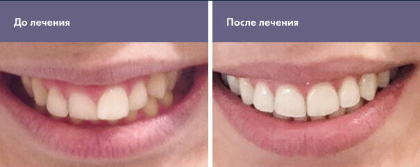 Пациенту 25 лет